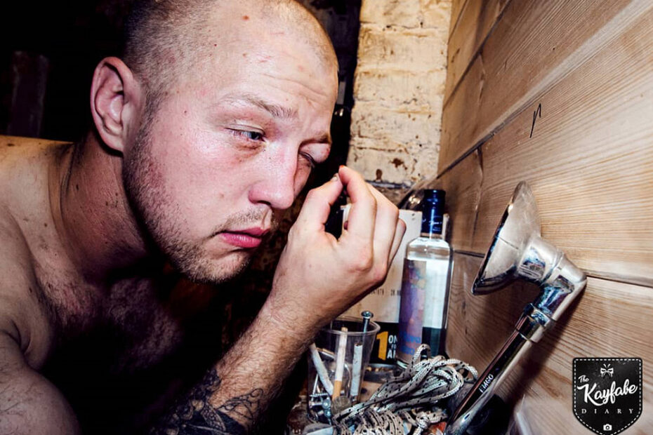 Professional wrestler Mikk Vainula of Estonia, treating his eye injury backstage after his wrestling match in the ring.